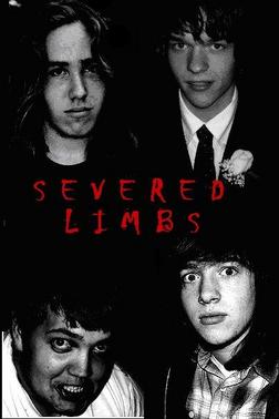 The Severed Limbs